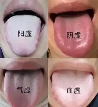 今天我们要聊聊关于阳气的话题，你知道阳气有两个来源吗？一个是心阳，一个是肾阳。
