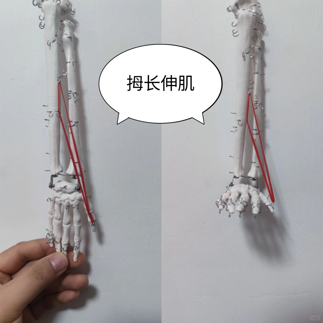 拇长伸肌