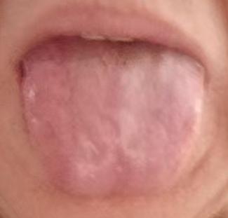 阳气亏虚难稳固，补脾固肾是关键，重拾身体底气







很多男同胞年纪不大，