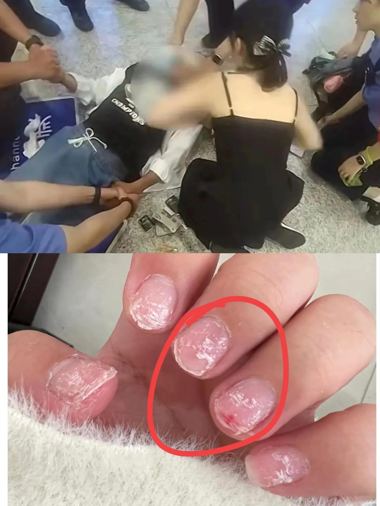 我老公不明白，只是急救了一个病人，
这护士为啥一下子就火了？
我说，你看看强力卸