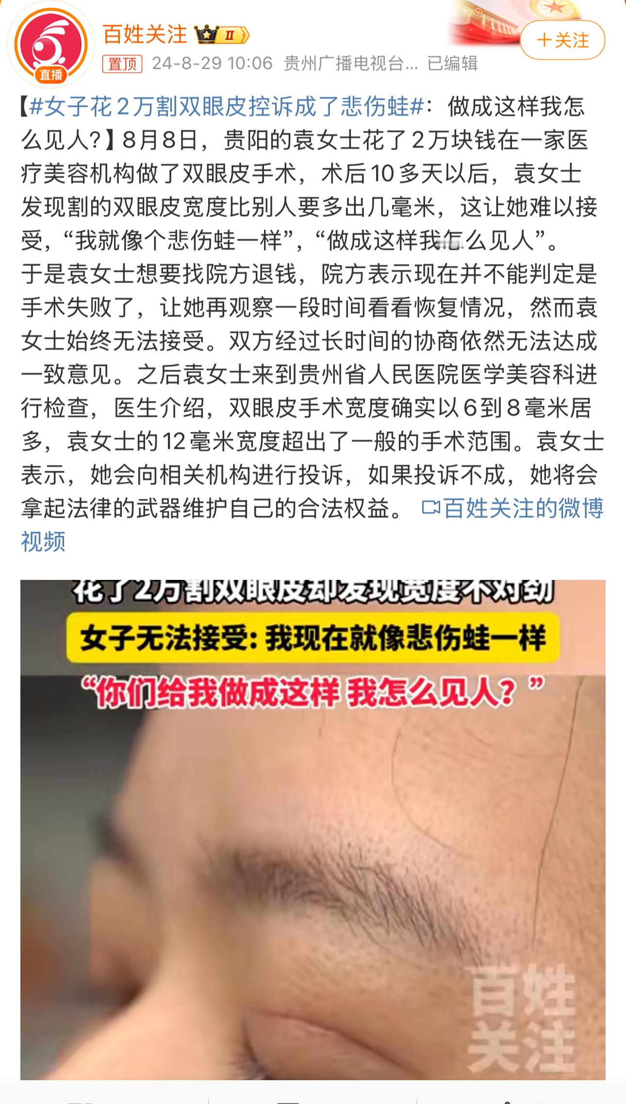 #女子花2万割双眼皮控诉成了悲伤蛙#虽然……但是……我知道，爱美之心人皆有之，但
