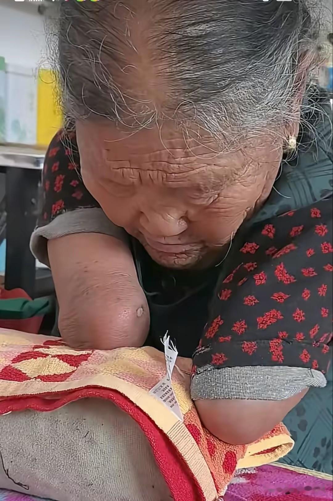 天生无四肢，嫁全村最穷的人，81岁却笑着对镜头说“我很幸福”
 
在甘肃会宁黄土