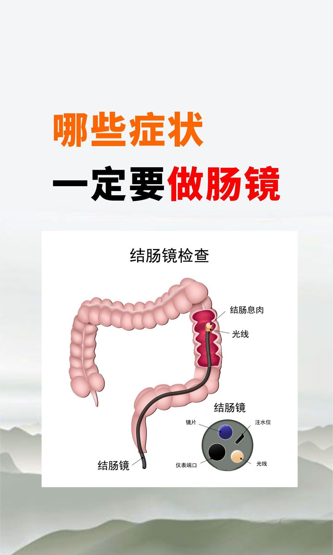 溃疡性结肠炎 溃疡性直肠炎 中医顾思臻 顾思臻 肠镜