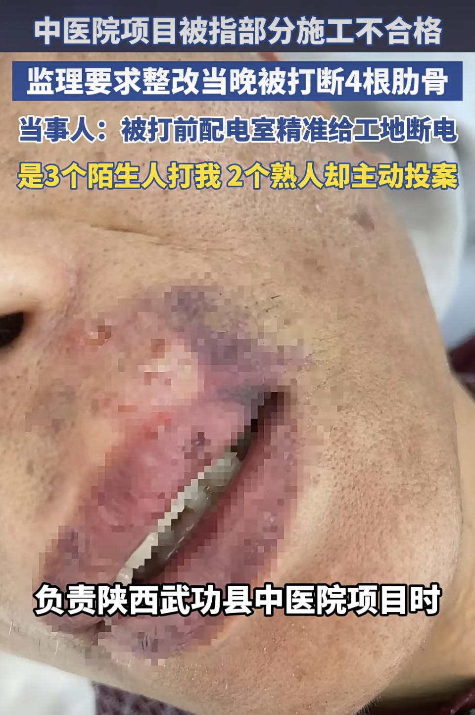 被打了4根肋骨，施工不合格，监理要求整改。这事该怎么说理？还有没有天理了？