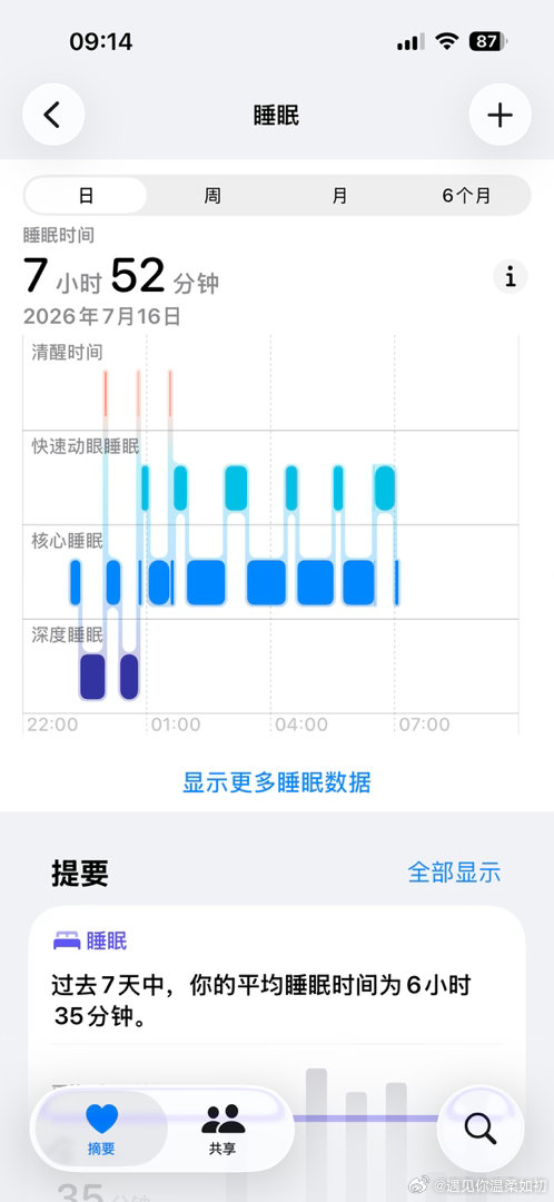 男女在睡眠上的生理机制差异男女在睡眠上的生理机制差异 在我看来，男的的睡眠质量就