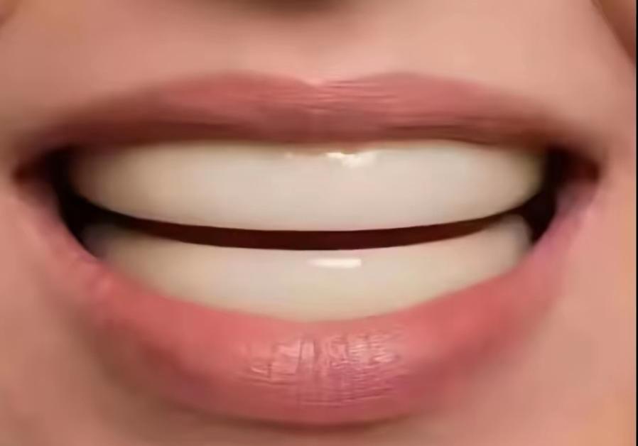 这张嘴笑起来好甜啊！我们的牙齿要是这样，吃东西就不塞牙了吧[呲牙]，也不坏牙了[