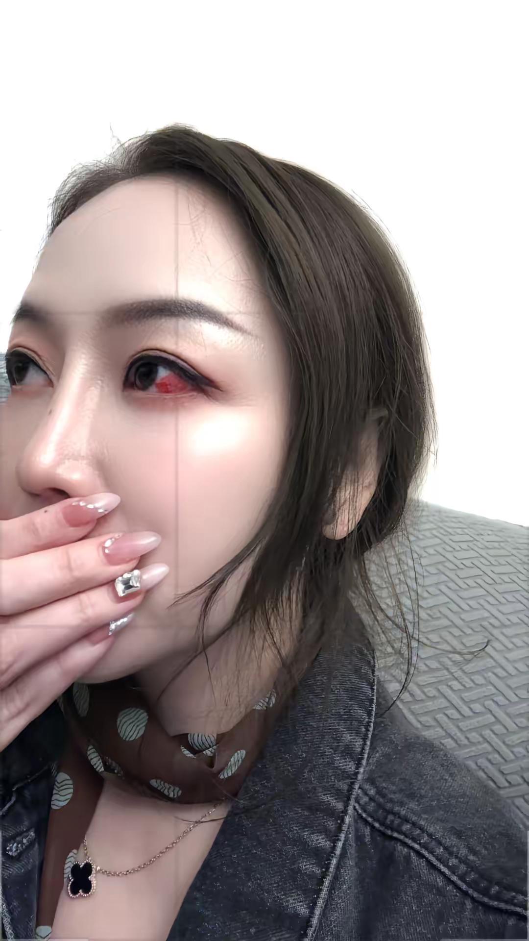 睡不好，这眼睛……吓到你了吗？