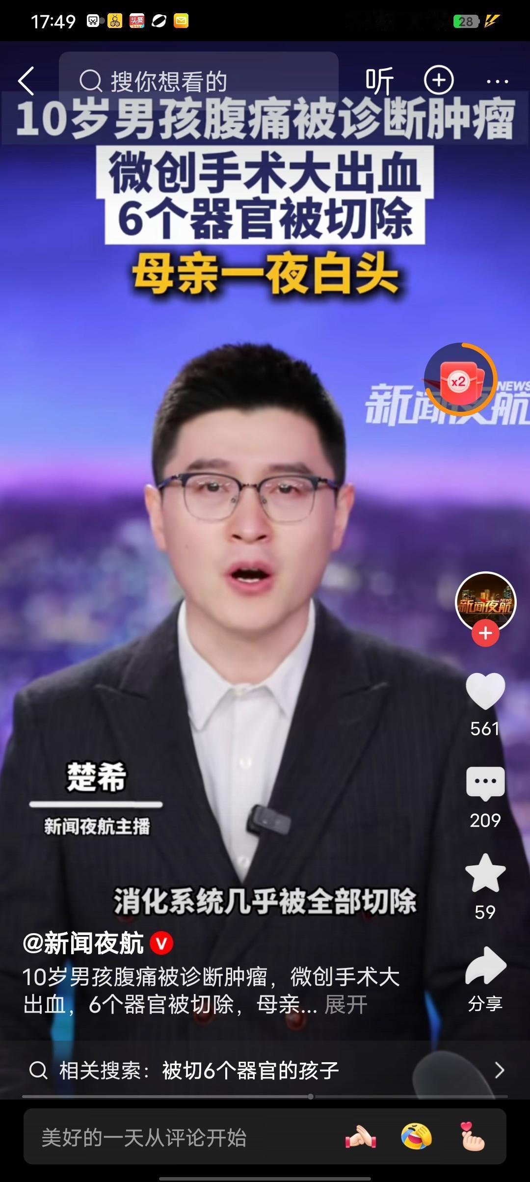 10岁男孩腹痛被诊为肿瘤，从微创到开腹切除6个器官。
2023年10月，山东菏泽