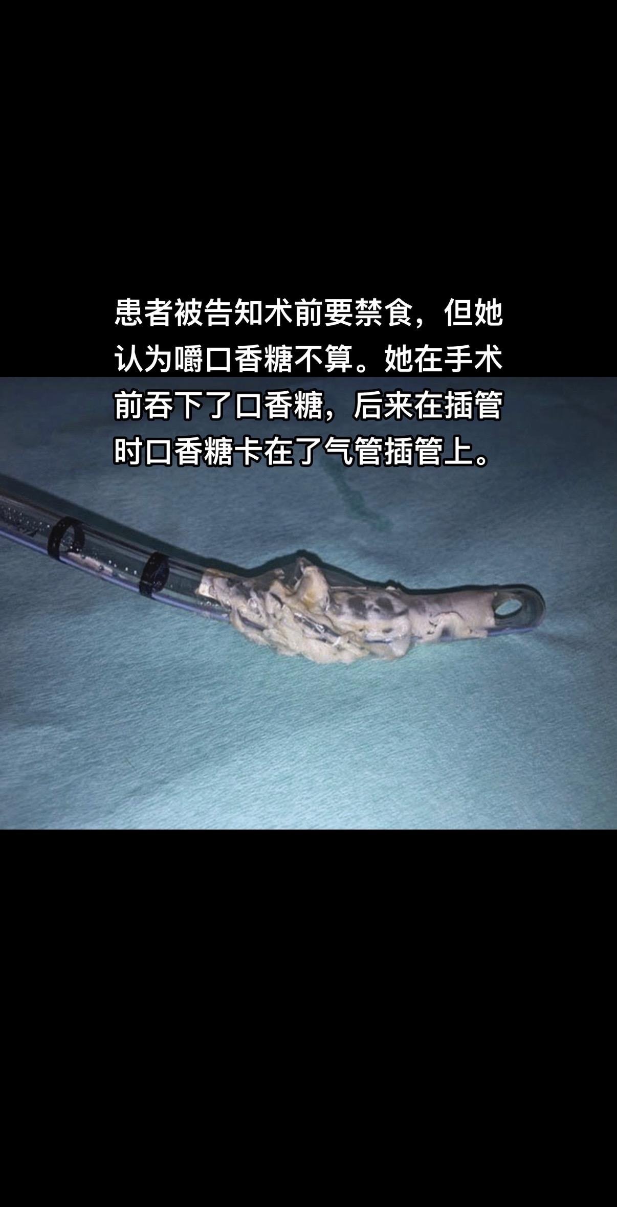 患者 急诊 急救 手术 病人
