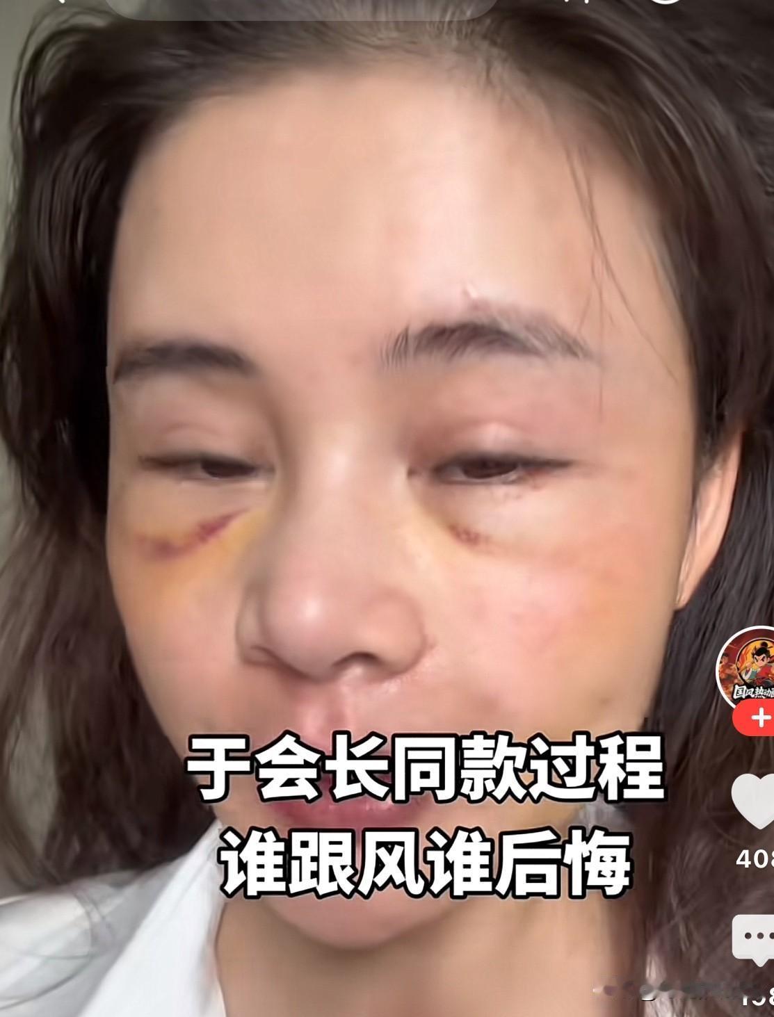 一看就是跟于文红一个生产线的！
每个人不是应该都有不同的方式么？怎么于文红的徒弟