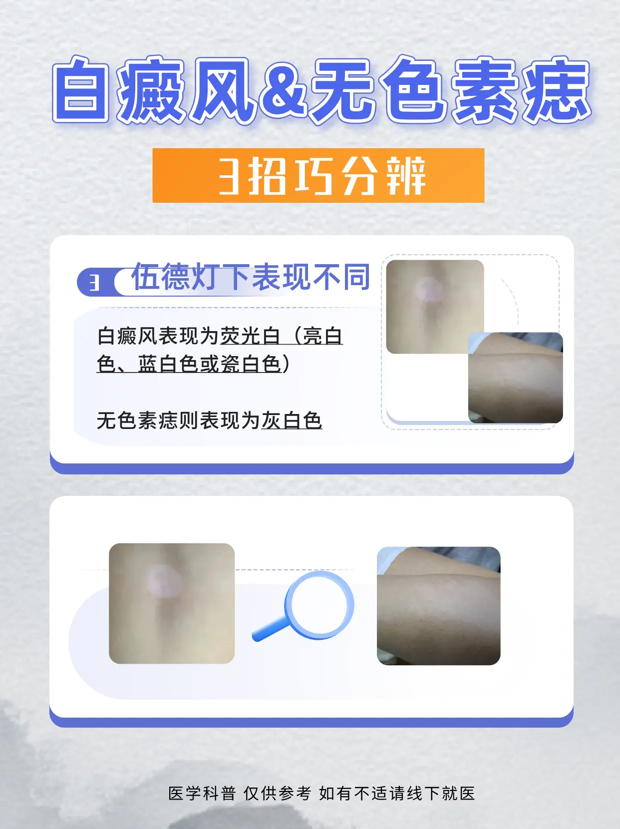 白斑分不清，3招巧分辨