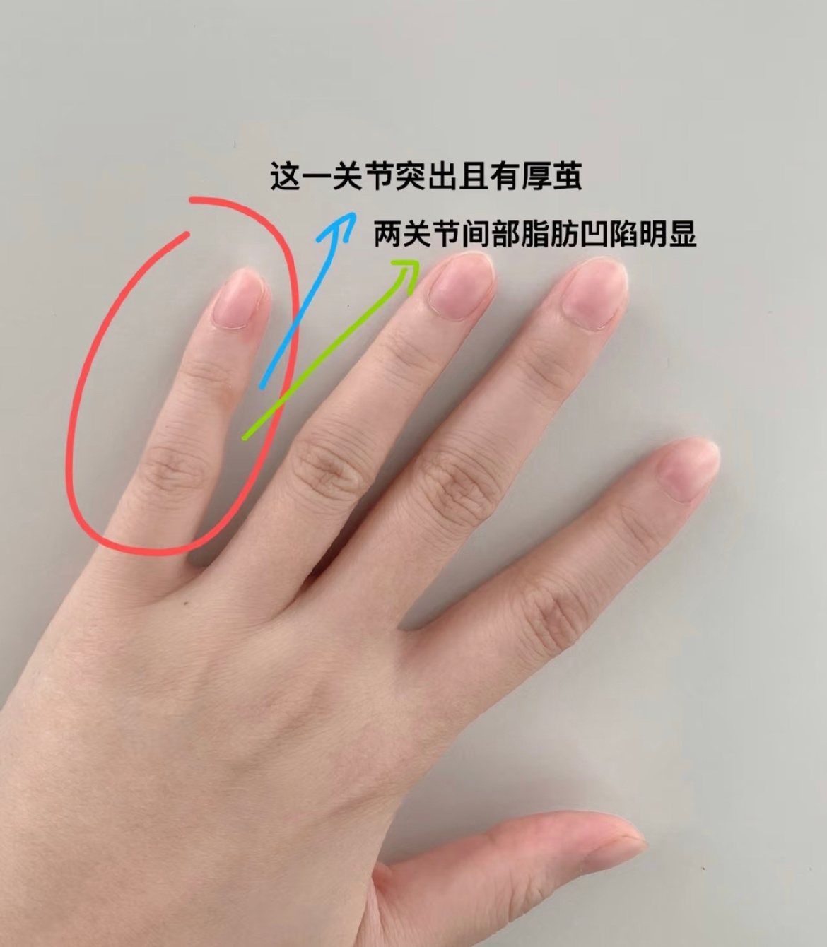 手机是我买过最回本的东西了玩回本多少取决于小拇指弯曲多少随机抽查，看看各位的小拇