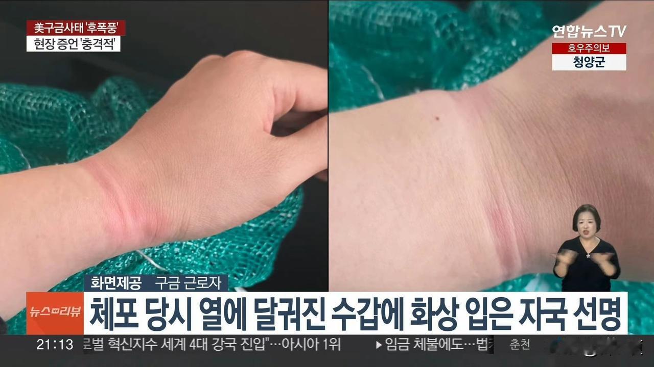 被美国扣押的韩国LG工程师回国后控诉在被拘期间遭受的虐待，被手铐灼烤、被注射未知