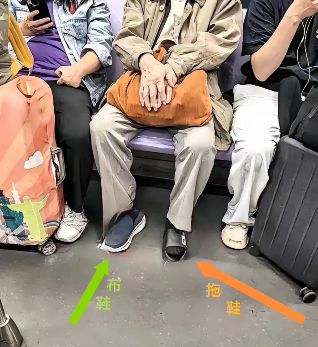 这位时上班走得急了还是脚有毛病呢？