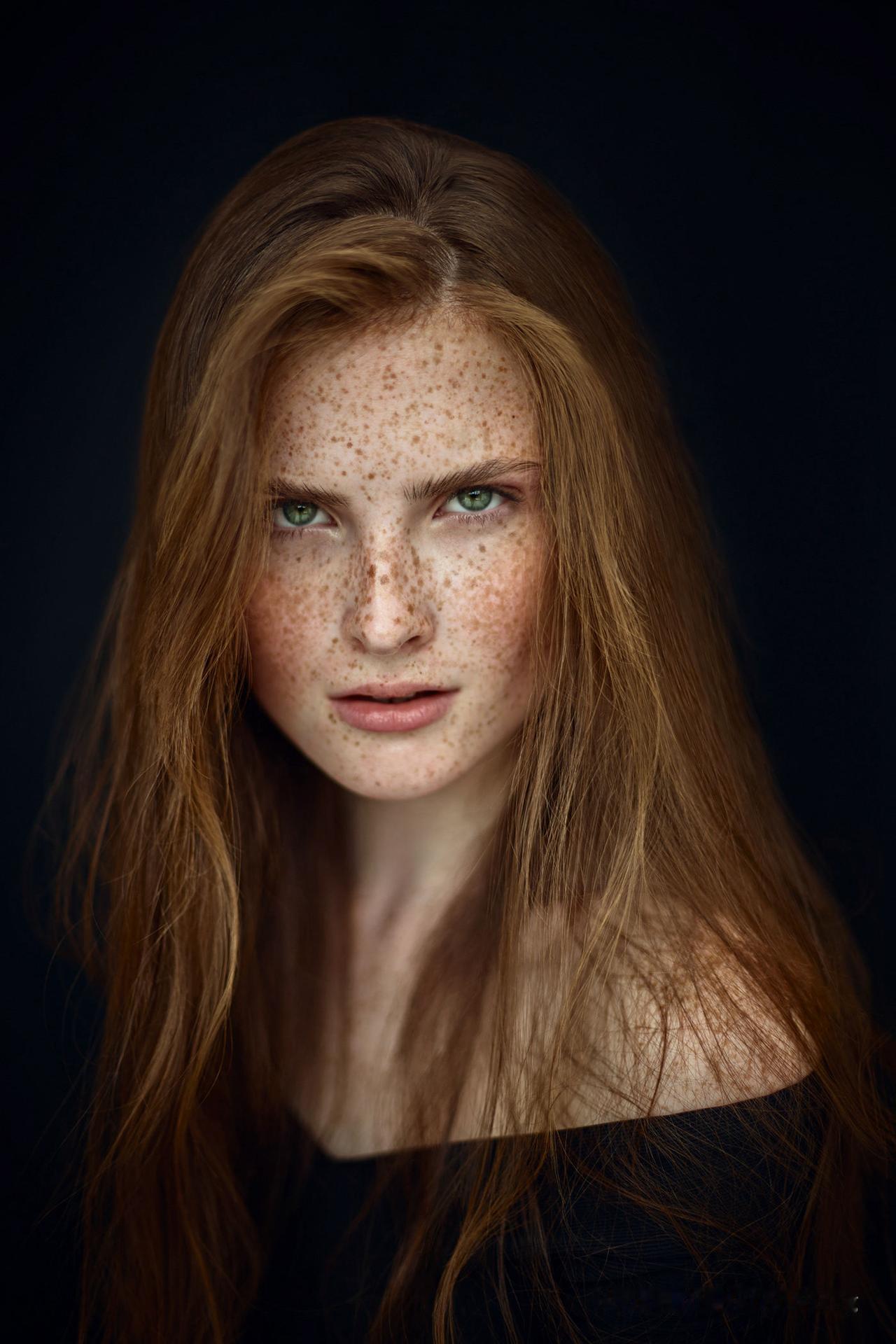 奇了怪了，欧洲人为什么认为这种浑身雀斑的女孩子很好看呢？理解不了！黄褐斑美女 欧