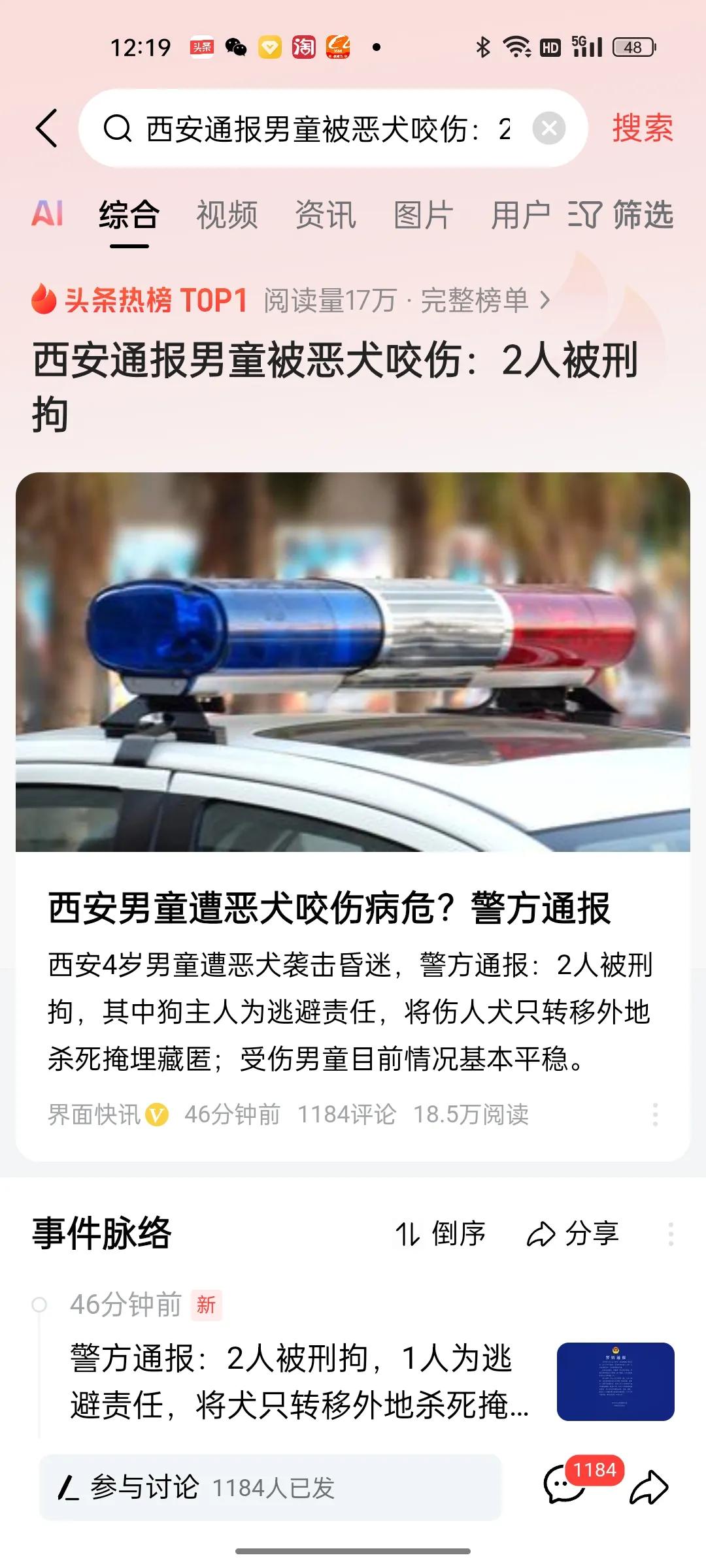 西安男童遭恶犬咬成重伤！警方通报来了！恶犬饲养人郭某没有拴绑狗致使狗将四岁男童咬