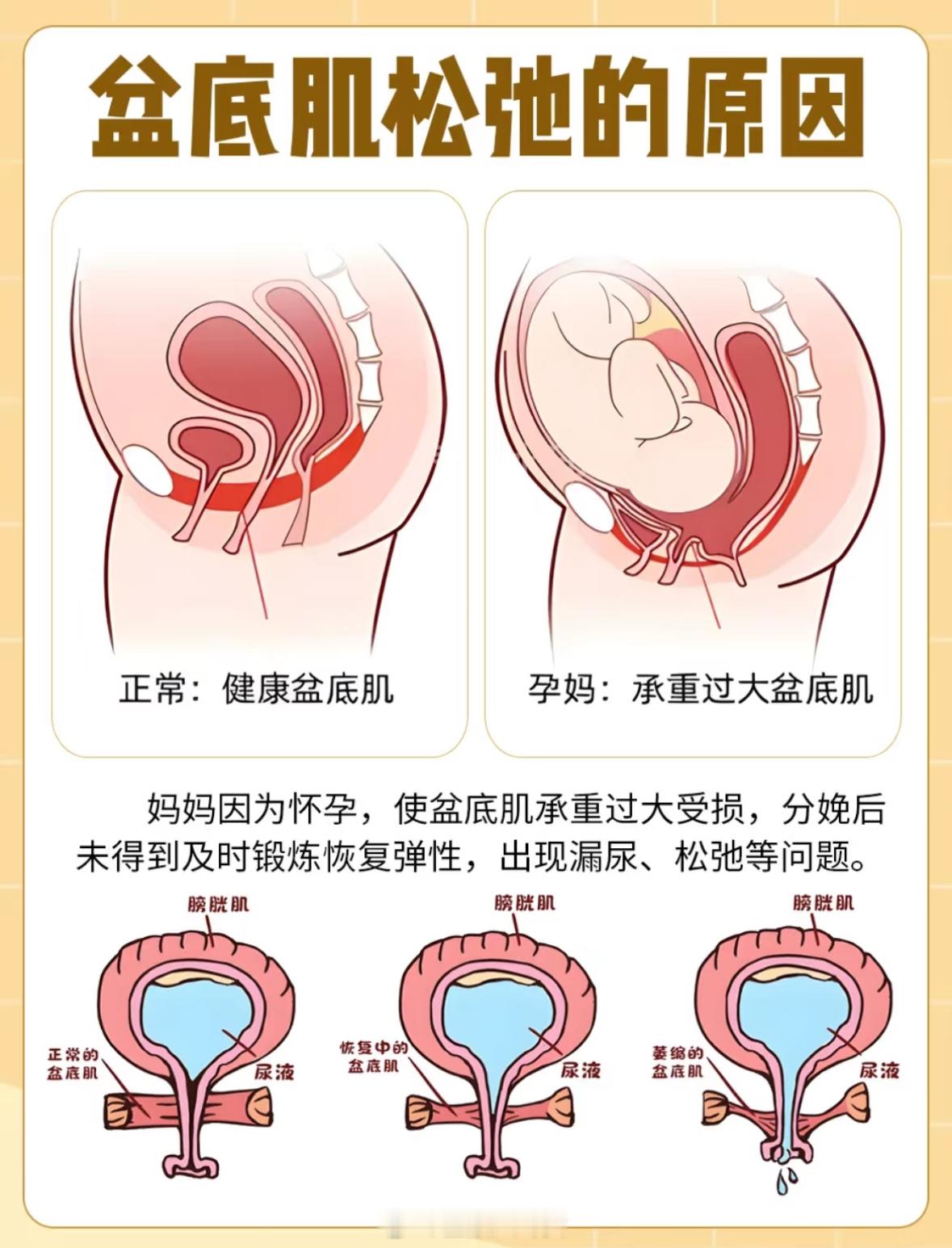 建议产后康复项目进医保提升产后康复、产后访视、预防接种等医疗服务水平，引入产后瑜