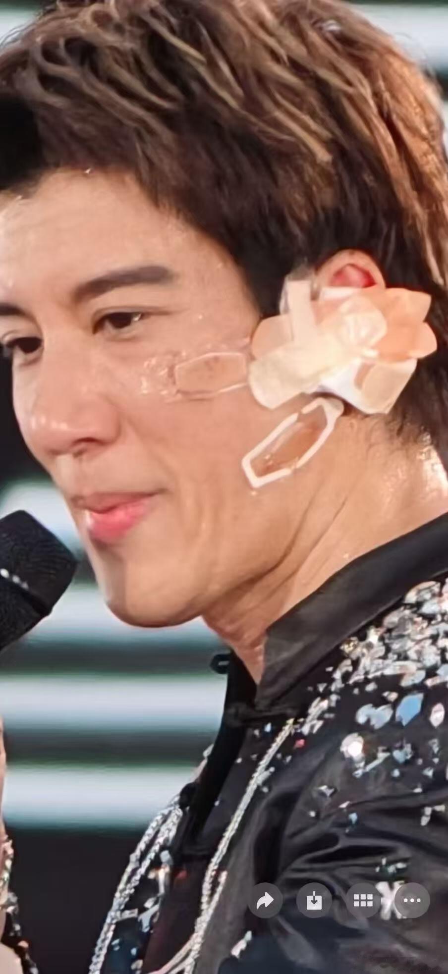 王力宏王力宏贴创口贴坚持完成演出王力宏仅用创口贴止血 王力宏摔倒受伤，仅用创口贴