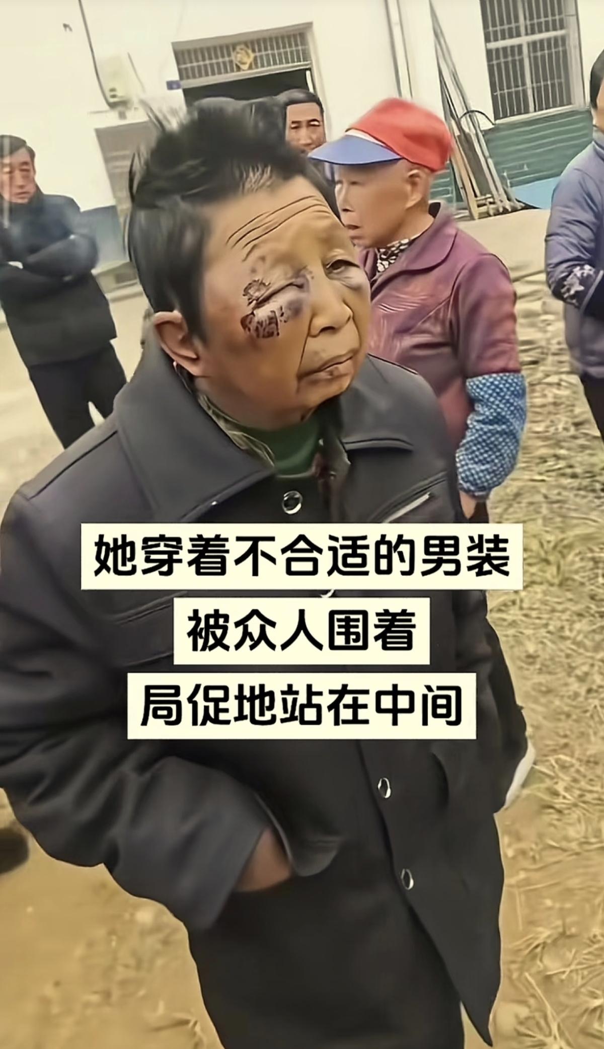 湖南平江老人家暴事件，七旬丈夫酒后打妻被拘！

近日，湖南平江县一起家暴事件受到