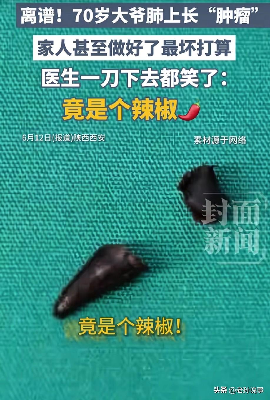 哭笑不得！ 6月12日，封面新闻报道，一位70岁大爷体检发现肺上长了"肿瘤"，一