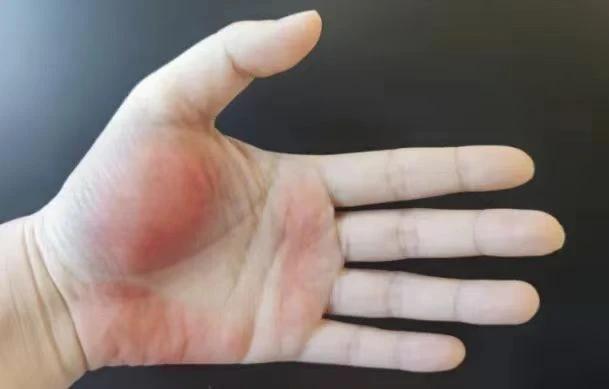 👆肝不好的人留意“一黄二红三黑”，
伤肝的10个习惯要改改了！🫷

肝脏