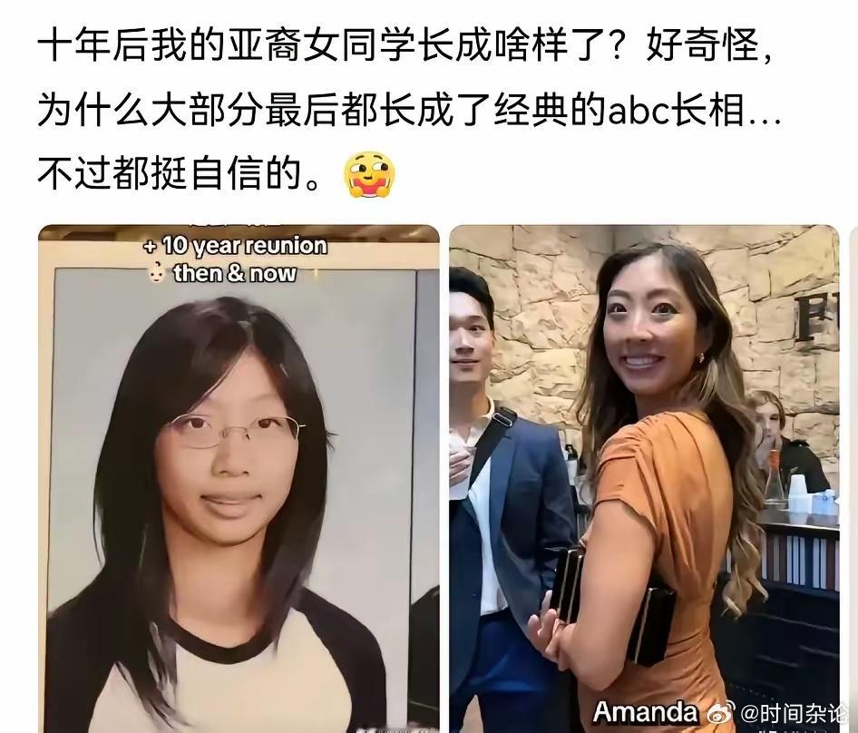 长期学的美式假笑，咧着个大嘴锻炼出来的脸部肌肉。 