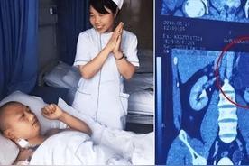"我的丈夫有4个肾！"2016年，贵州一男子天生神力，可以把白酒当水喝，除此之外