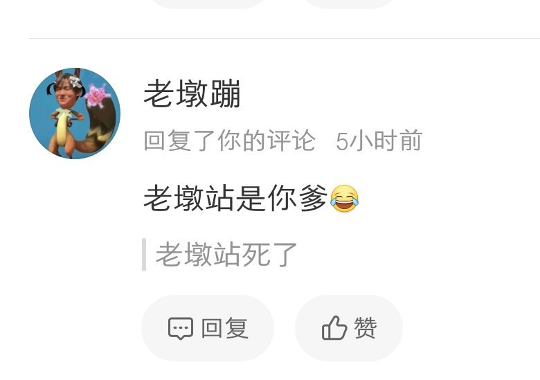 怎么老墩站还有腿毛，， 