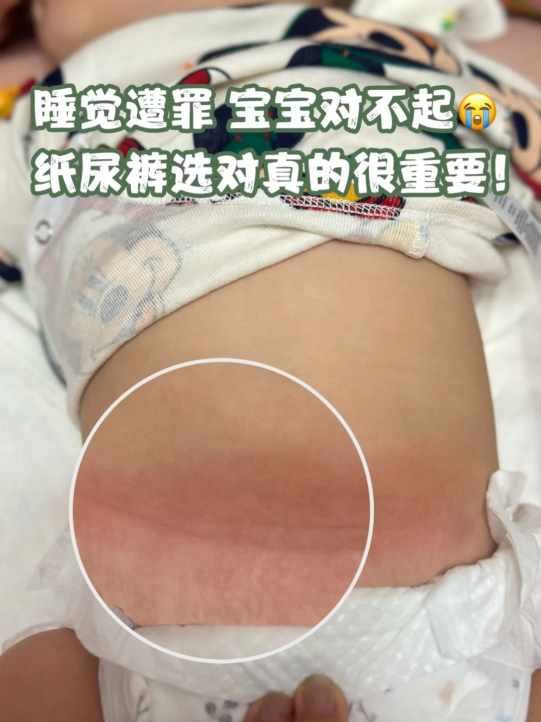 睡渣宝宝逆袭！0打扰睡眠秒get！