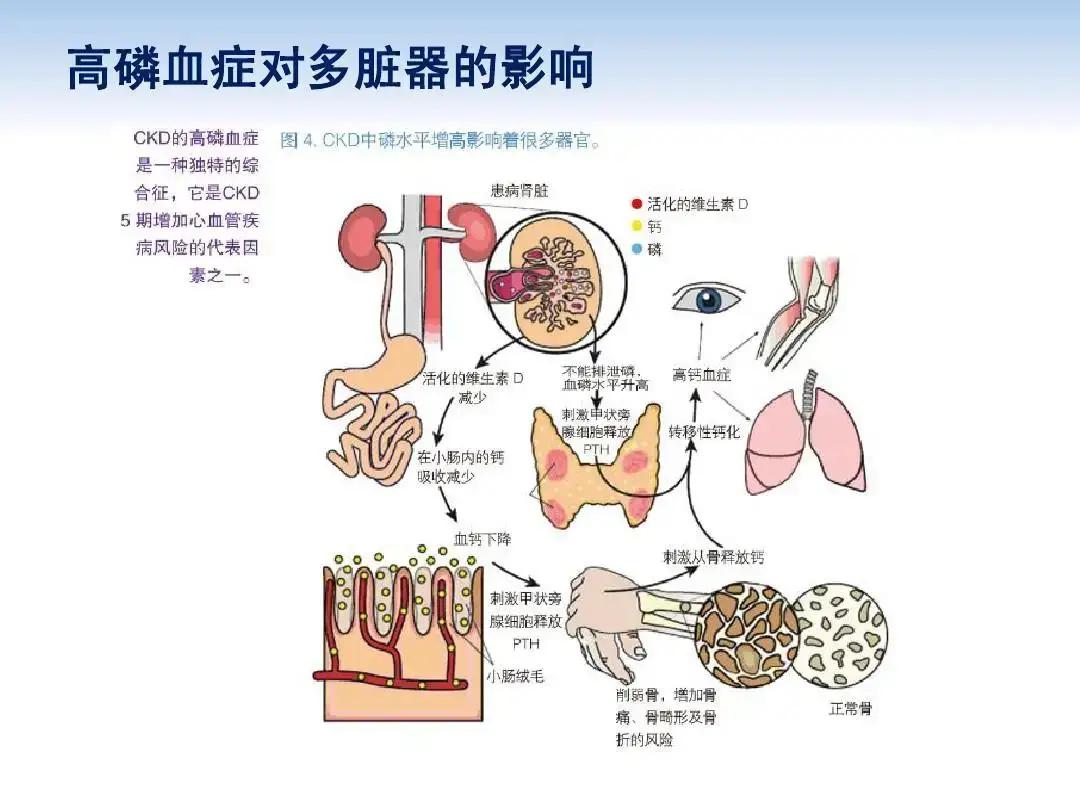 骨头酸痛别硬扛！警惕身体里的“隐形杀手”，这场生命修行需身心双调

诸位朋友，今