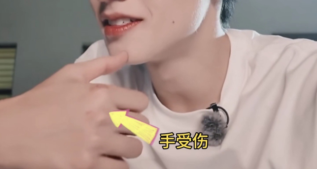 总是来不及问你受伤了痛不痛喜欢黄色就送他黄海好不好🥺场内志愿者招募：网页链接