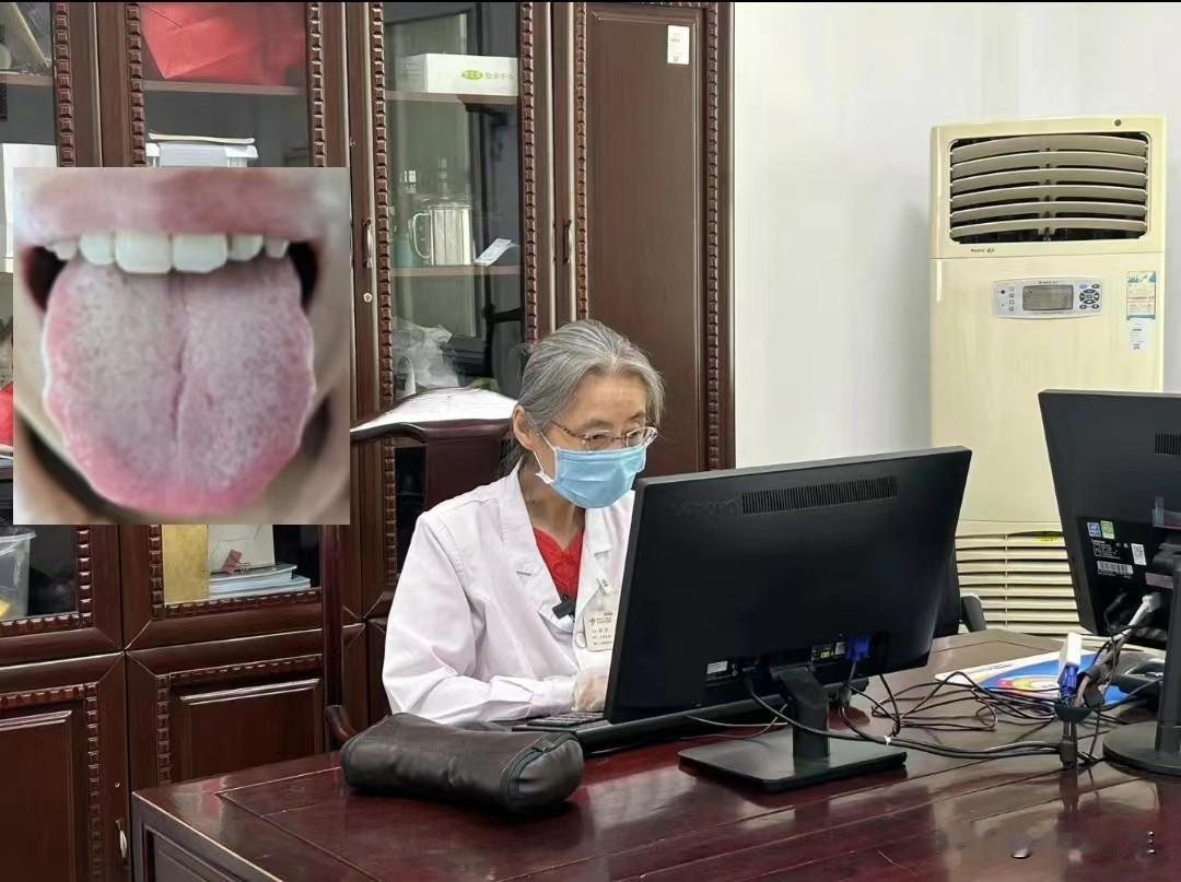 舌中有裂纹，不要上来就补脾，小心越补越虚

这是一位45岁的女同志，自述平时脾气