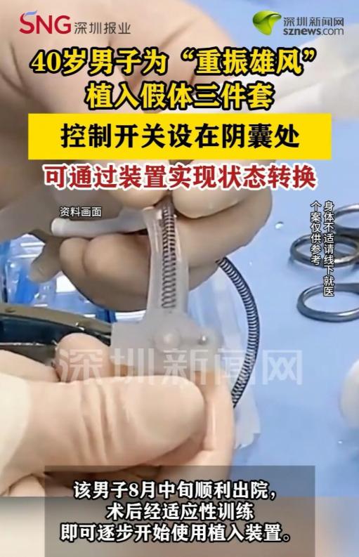 深圳，一名 40 岁男子看着妻子渴望的眼神，直接让医生给他植入假体三件套。有了这