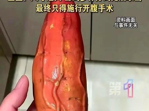 凌晨四点的成都，急诊室的门被猛地推开。一个61岁的男人捂着肚子，满头大汗地弯着腰