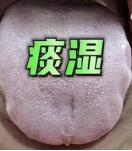 湿气的天敌，不管痰湿、寒湿、湿热，三药，通过舌象统统帮你搞定！

首先来看痰湿的