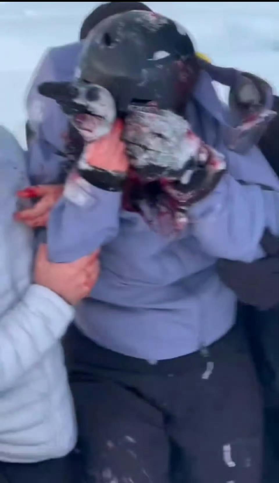 可可托海雪豹伤人事件刷屏了，大概刷了刷，看到大家都在替雪豹说话我也就放心了。
