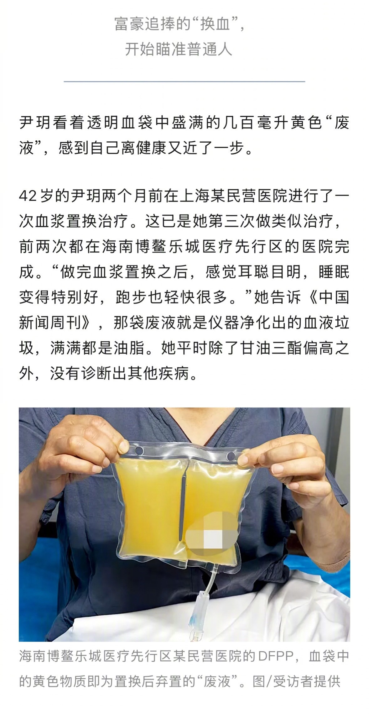 富豪追捧的换血开始瞄准普通人42岁的尹玥因甘油三酯偏高，已接受了三次血浆置换，做