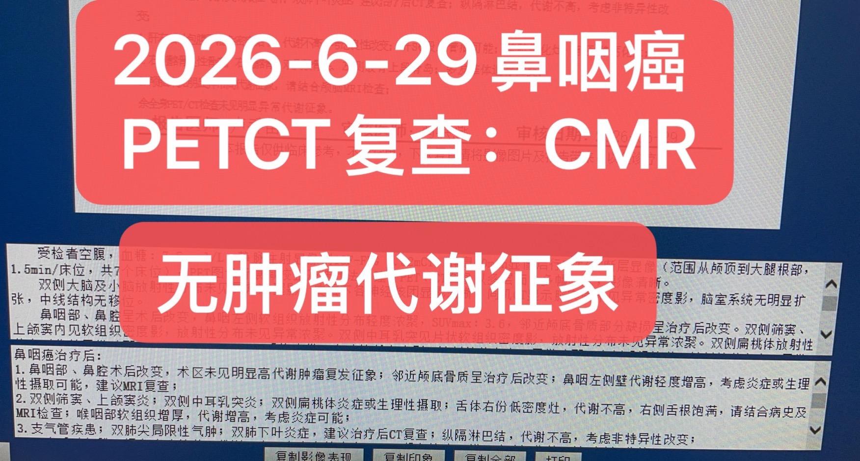 严重的局部晚期鼻咽癌的挽救。患者，男，39岁。 于2025年4月因头痛...
