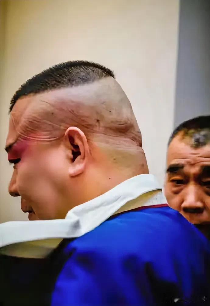看看这个勒痕就知道郭德纲是真的喜欢唱戏！
就郭德纲的名气有太多挣钱的事情可以干，