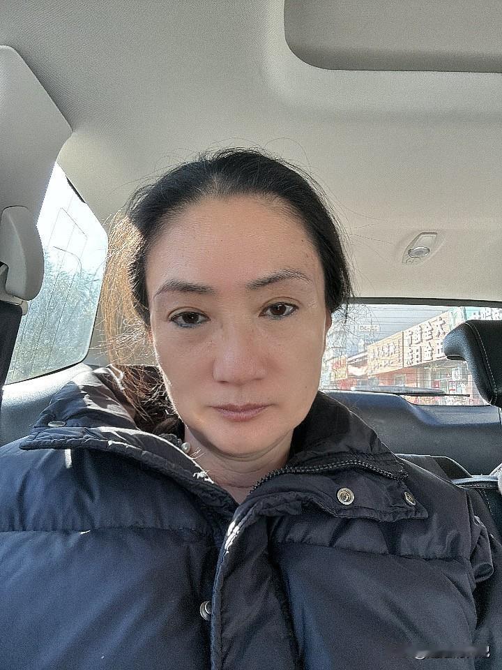 接受不了自己有皱纹！
都感觉自己焦虑了，容貌焦虑……
回来第一件事打除皱
这次打