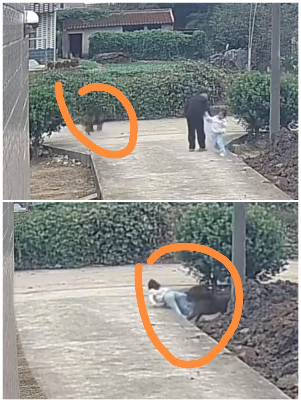 太危险了，一个小女孩被大型犬撕咬，这只犬当时没有栓绳，大腿出现了淤青。看了视频，