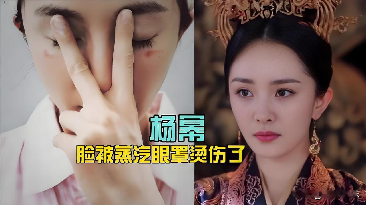 杨幂的脸差点被“咬”了，还是被一个蒸汽眼罩。

你能想象吗？一个放松眼睛的东西，