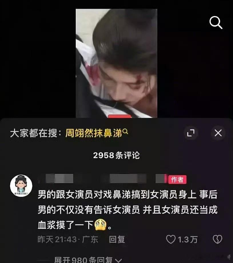 细心网友发现周翊然对戏把鼻涕流在女演员身上了，这算工伤吗 ​​​