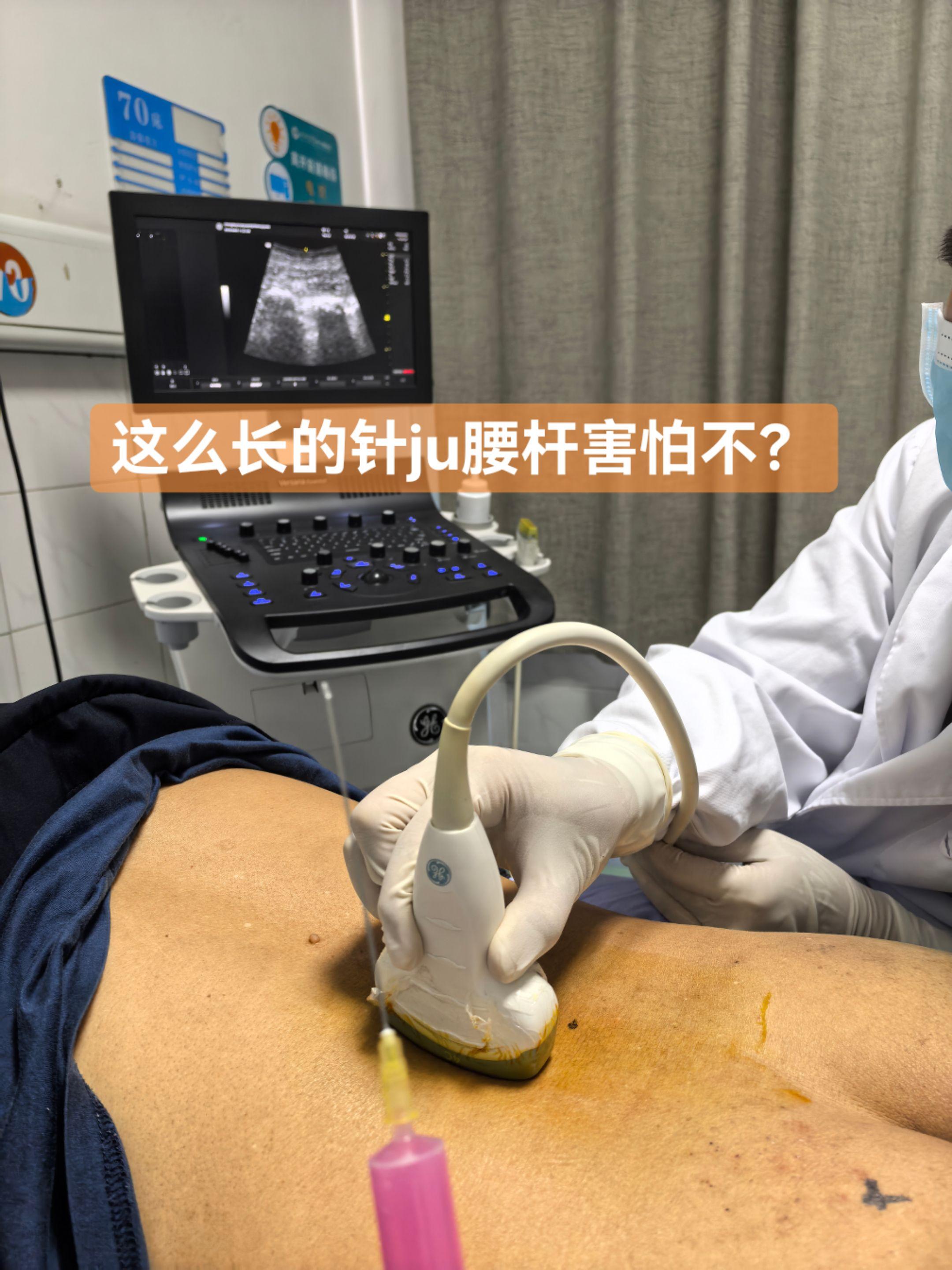 不用害怕，超声可视化看的很清楚，椎间盘卡压坐骨神经出口，针短了到不了位置。