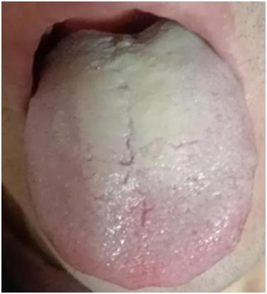 痰湿+阳虚+肝淤+脾虚，疏肝健脾、升阳化痰却无效，那是因为忽略的这一点

很多人