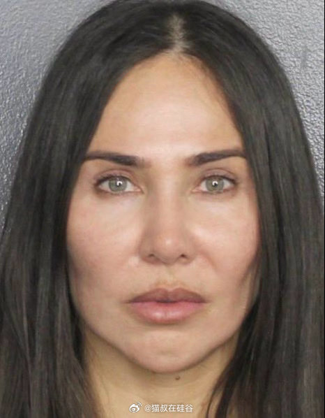 模仿卡戴珊填充臀部，却死于非法行医OnlyFans网红Christina Ash