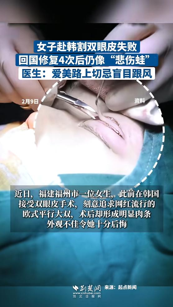 “悲剧还是发生了！”近日，福建福州，一女子为了变美，专门跑去韩国去做双眼皮手术，