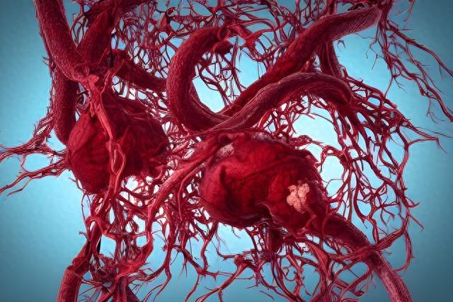 结节、息肉、痰湿，根源就是气血不通！一个常用中成药，帮你全身疏通
大家好，我是中