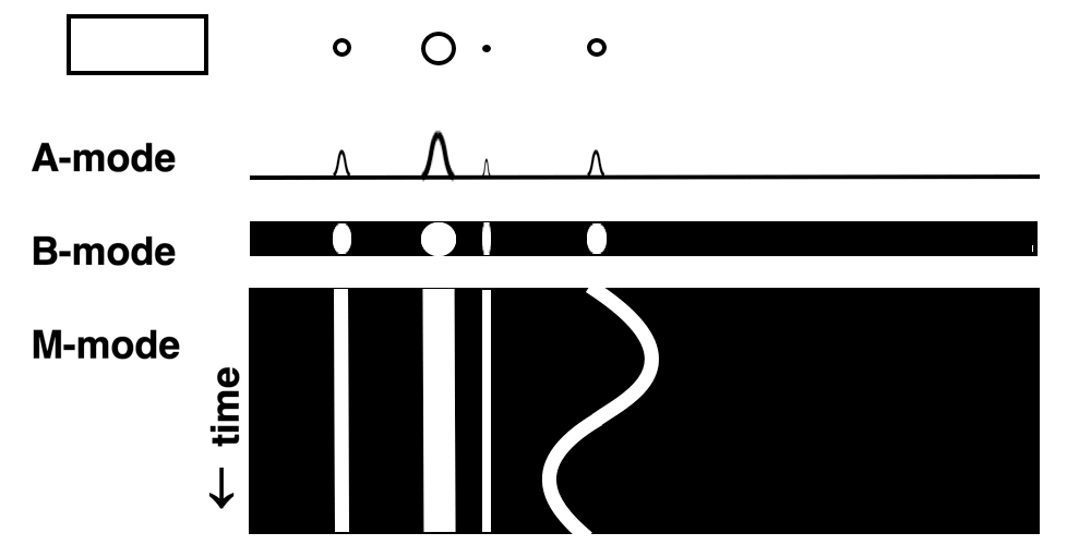 运动康复 刚刚提到了超声，想起之前一个提问：既然有B超检查，那有没有A超或者C超