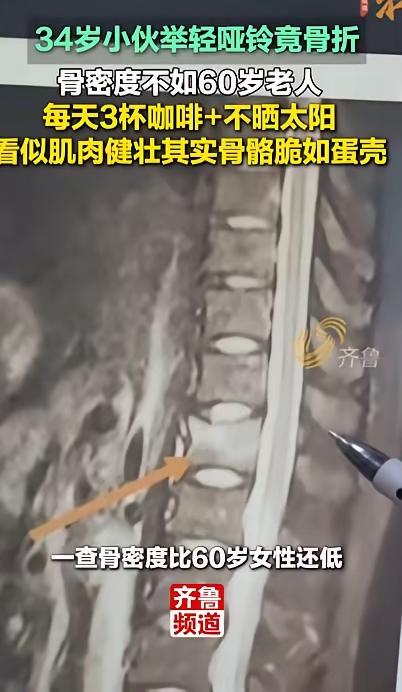 “悲剧还是发生了！”近日，浙江，一男子经常健身，看着很健康，却在健身房举哑铃时，